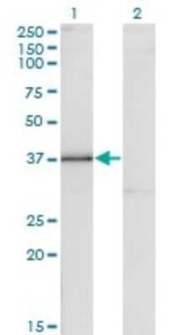 DLX3 Antibody (3F7), Novus Biologicals 0.1 mg | Buy Online | Novus Biologicals | Fisher Scientific
