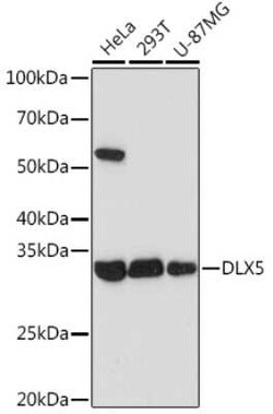 DLX5 Rabbit anti-Human, Clone: 2F9C6, Novus Biologicals 100 &mu;g; Unconjugated:Antibodies,