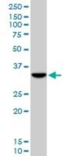 DLX5 Antibody (3B11), Novus Biologicals 0.1 mg | Buy Online | Novus Biologicals | Fisher Scientific
