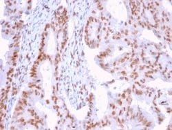 DMC1 Antibody (2H12/4) - Azide and BSA Free, Novus Biologicals 100 &mu;g;