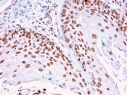 DMC1 Antibody (2H12/4) - Azide and BSA Free, Novus Biologicals 100 &mu;g;