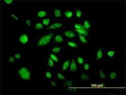 DNA Polymerase Kappa Antibody (6F2), Novus Biologicals 0.1 mg | Buy Online | Novus Biologicals | Fisher Scientific
