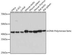 DNA Polymerase beta Rabbit anti-Human, Mouse, Rat, Clone: 6M8I5, Novus