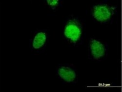 DNA Polymerase beta Antibody, Novus Biologicals 0.05 mg | Buy Online | Novus Biologicals | Fisher Scientific