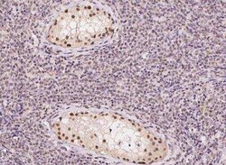 DNA Polymerase beta Antibody, Novus Biologicals:Antibodies:Primary Antibodies