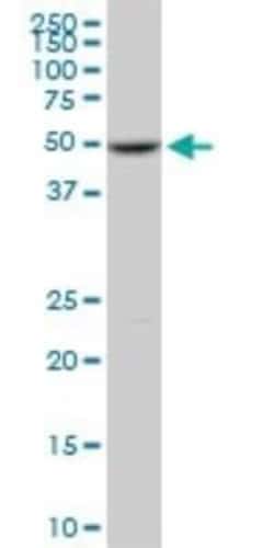 DNA Polymerase epsilon p59 Antibody (1A3), Novus Biologicals 0.1 mg | Buy Online | Novus Biologicals | Fisher Scientific