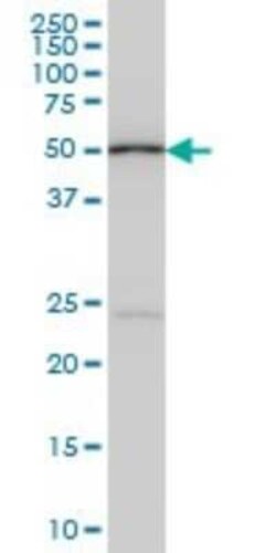 DNA Polymerase epsilon p59 Antibody (1A3), Novus Biologicals 0.1 mg | Buy Online | Novus Biologicals | Fisher Scientific
