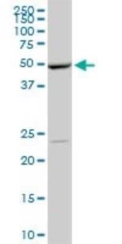 DNA Polymerase epsilon p59 Antibody (1A3), Novus Biologicals 0.1 mg | Buy Online | Novus Biologicals | Fisher Scientific