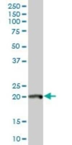 DNA Polymerase epsilon subunit 3 Antibody, Novus Biologicals 0.05 mg | Buy Online | Novus Biologicals | Fisher Scientific
