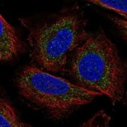 DNA Polymerase gamma Rabbit anti-Human, Polyclonal, Novus Biologicals 100