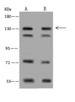 DNA Polymerase gamma Antibody, Novus Biologicals:Antibodies:Primary Antibodies