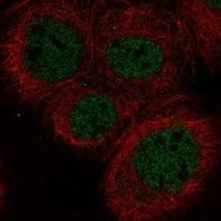 DNA Polymerase lambda Rabbit anti-Human, Polyclonal, Novus Biologicals