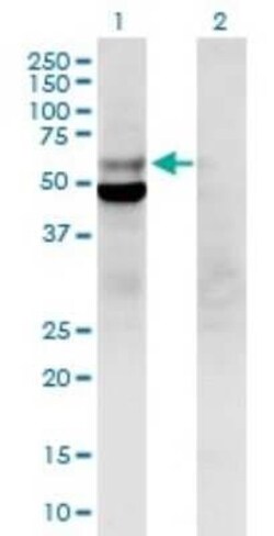 DNA polymerase delta p50 Antibody, Novus Biologicals 50 &mu;g | Buy Online | Novus Biologicals | Fisher Scientific