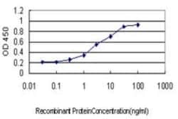 DNA polymerase sigma Antibody (2F8), Novus Biologicals 0.1 mg, Unconjugated:Antibodies,
