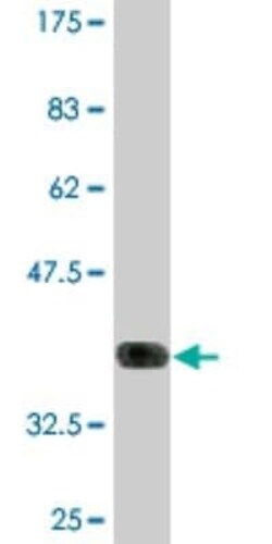 Novus Biologicals DNA polymerase theta Antibody (1C11), Novus Biologicals 0.1 mg | Buy Online | Novus Biologicals | Fisher Scientific