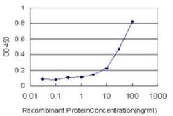 DNAJA4 Antibody (4B4-1F2), Novus Biologicals 0.1 mg | Buy Online | Novus Biologicals | Fisher Scientific