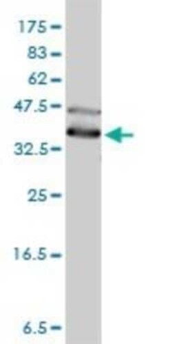 DNAJA4 Antibody (4B4-1F2), Novus Biologicals 0.1 mg | Buy Online | Novus Biologicals | Fisher Scientific