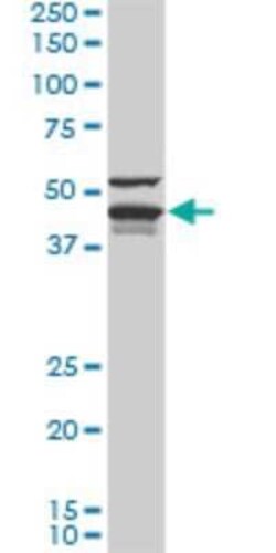 DNAJA4 Antibody (4B4-1F2), Novus Biologicals 0.1 mg | Buy Online | Novus Biologicals | Fisher Scientific