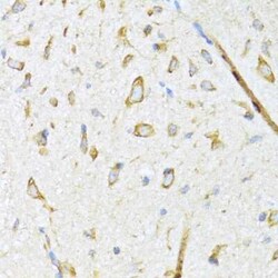 DNAJB11 Antibody - Azide and BSA Free, Novus Biologicals 0.1 mL, Unconjugated:Antibodies,