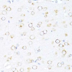 DNAJB11 Antibody - Azide and BSA Free, Novus Biologicals 0.1 mL, Unconjugated:Antibodies,