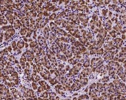 DNAJB11 Antibody, Novus Biologicals 100 &mu;g; Unconjugated:Antibodies,