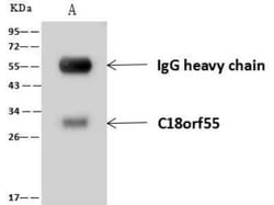 DNAJB11 Antibody, Novus Biologicals 100 &mu;g; Unconjugated:Antibodies,