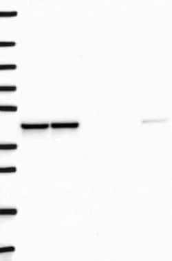DNAJB12 Rabbit anti-Human, Polyclonal, Novus Biologicals 100 &mu;g; Unconjugated:Antibodies,