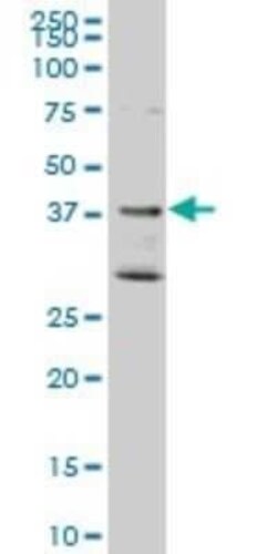 DNAJB2 Antibody (1B7), Novus Biologicals 0.1 mg | Buy Online | Novus Biologicals | Fisher Scientific