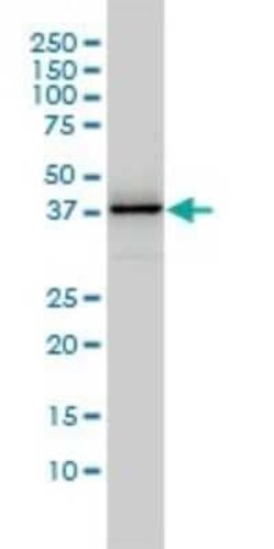 DNAJB4 Antibody (1H2-3G4), Novus Biologicals 0.1 mg | Buy Online | Novus Biologicals | Fisher Scientific