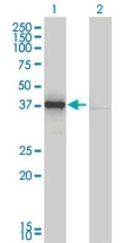 DNAJB4 Antibody (1H2-3G4), Novus Biologicals 0.1 mg | Buy Online | Novus Biologicals | Fisher Scientific