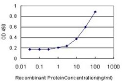 DNAJB5 Antibody (1C3), Novus Biologicals 0.1 mg | Buy Online | Novus Biologicals | Fisher Scientific