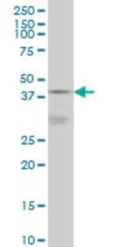 DNAJB5 Antibody (1C3), Novus Biologicals 0.1 mg | Buy Online | Novus Biologicals | Fisher Scientific