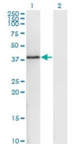 DNAJB6 Antibody (1A5), Novus Biologicals 0.1 mg | Buy Online | Novus Biologicals | Fisher Scientific