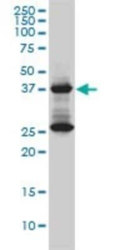 DNAJB6 Antibody (2C11-C1), Novus Biologicals 0.1 mg | Buy Online | Novus Biologicals | Fisher Scientific