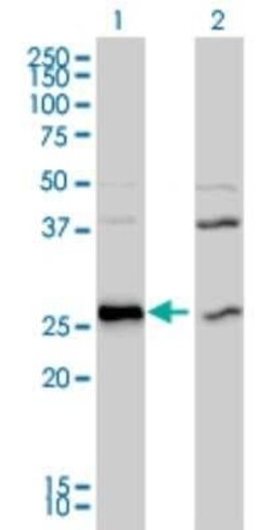 DNAJB6 Antibody (2C11-C1), Novus Biologicals 0.1 mg | Buy Online | Novus Biologicals | Fisher Scientific