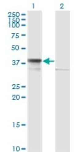 DNAJB6 Antibody (2D12-B9), Novus Biologicals 0.1 mg | Buy Online | Novus Biologicals | Fisher Scientific