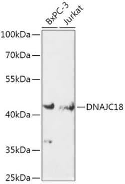 DNAJC18 Antibody - Azide and BSA Free, Novus Biologicals:Antibodies:Primary
