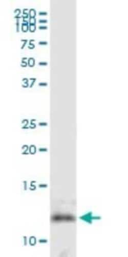 DNAJC19 Antibody, Novus Biologicals 0.05 mg | Buy Online | Novus Biologicals | Fisher Scientific