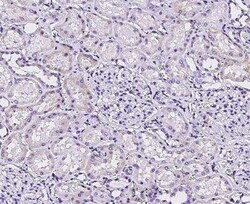 DNAJC30 Antibody, Novus Biologicals 50 &mu;g; Unconjugated:Antibodies,