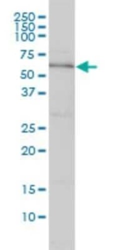 DNAJC7 Antibody (4G6-G3), Novus Biologicals 0.1 mg | Buy Online | Novus Biologicals | Fisher Scientific