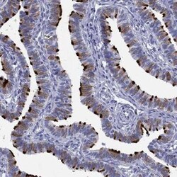 DNALI1 Rabbit anti-Human, Polyclonal, Novus Biologicals 25 &mu;g; Unconjugated:Antibodies,