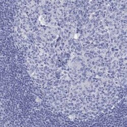 DNALI1 Rabbit anti-Human, Polyclonal, Novus Biologicals 25 &mu;g; Unconjugated:Antibodies,