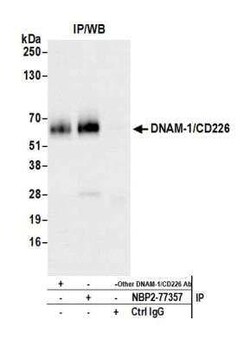 DNAM-1/CD226 Antibody (BLR063G), Novus Biologicals 100 &mu;g, Unconjugated:Antibodies,