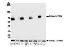 DNAM-1/CD226 Antibody (BLR063G), Novus Biologicals 100 &mu;g, Unconjugated:Antibodies,