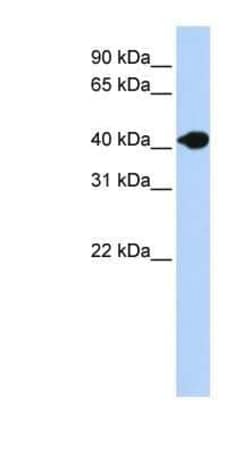 DNASE2B Antibody, Novus Biologicals 100 &mu;g; Unconjugated:Antibodies,