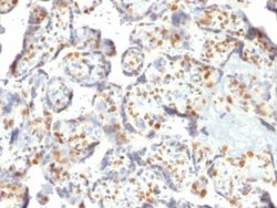 DNMT3A Antibody (PCRP-DNMT3A-1E2) - Azide and BSA Free, Novus Biologicals