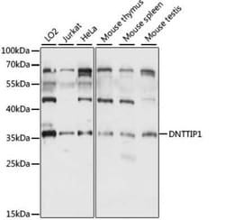 DNTTIP1 Antibody - Azide and BSA Free, Novus Biologicals 0.1 mL, Unconjugated:Antibodies,