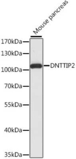 DNTTIP2 Antibody - Azide and BSA Free, Novus Biologicals:Antibodies:Primary