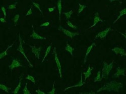 DNase II Antibody, Novus Biologicals 50 &mu;g, Unconjugated:Antibodies,