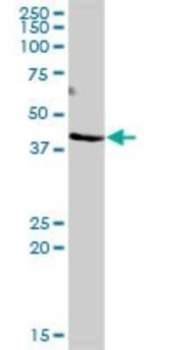DOC2B Antibody, Novus Biologicals 50 &mu;g | Buy Online | Novus Biologicals | Fisher Scientific